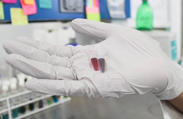resonancia magnética para la detección del cáncer de próstata en el oeste de Florida resonancia magnética para la detección del cáncer de próstata en el oeste de Florida