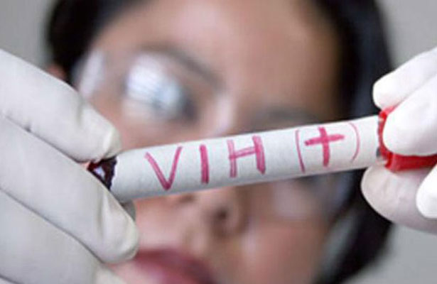 Con VIH, 2 de cada 100 universitarios veracruzanos que se someten a prueba