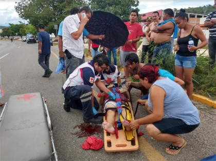 Dama grave al ser arrollada por automovilista