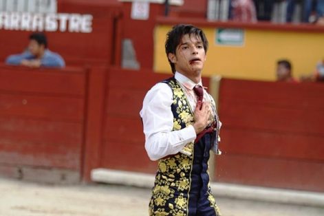 El peruano Rivera del Pilar sufrió una herida en el rostro. / Francisco H. REYES