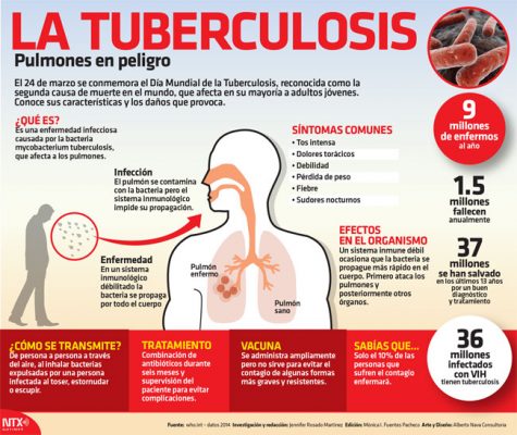Resultado de imagen para imagens de tuberculosis