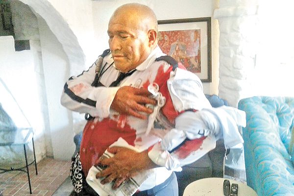 Hieren a vigilante por frustrar atraco en Coyoacán; detienen a un hombre