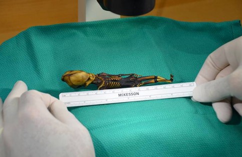 Esqueleto de Atacama era una niña con una enfermedad ósea, dice estudio Esqueleto de Atacama era una niña con una enfermedad ósea, dice estudio